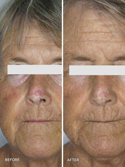 Liquid Gold with 5% Glycolic Acid