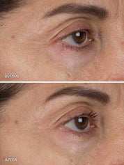 Liquid Gold Firming Eye Cream