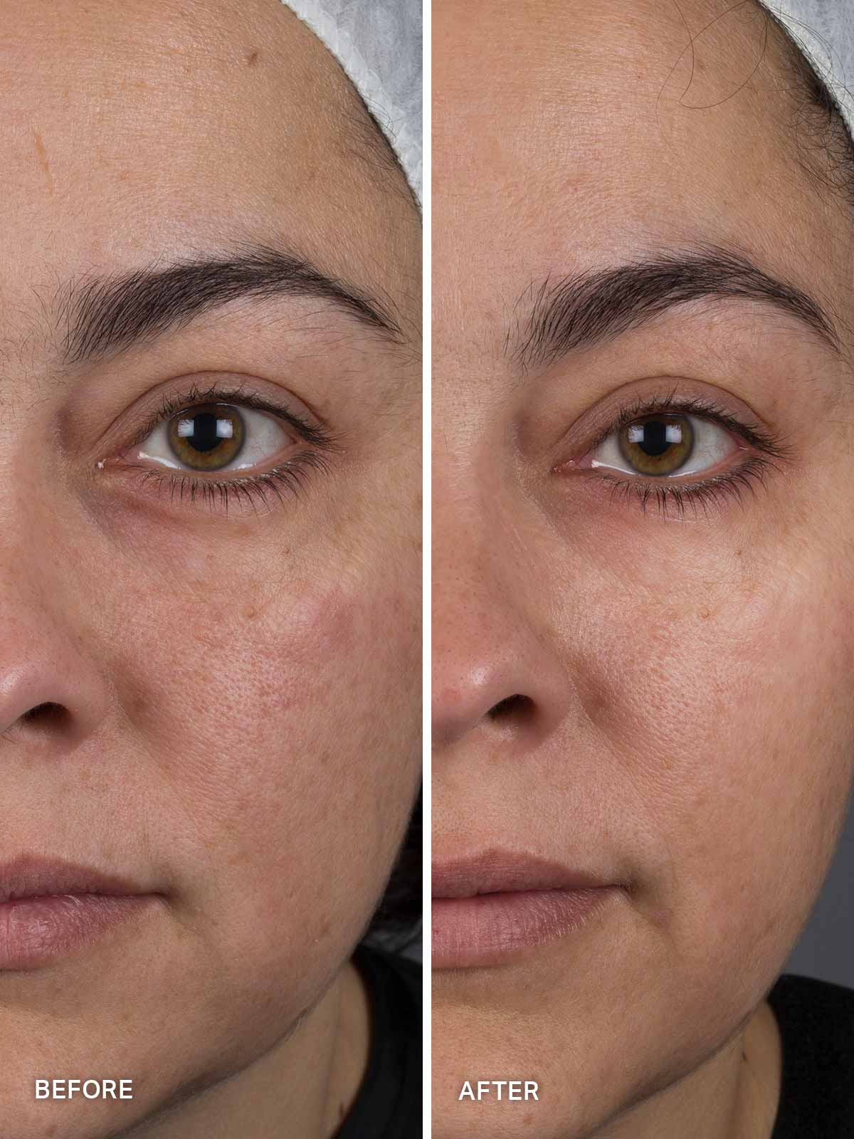 Liquid Gold Ultimate Perfecting Mask