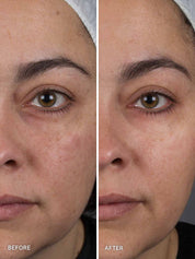 Liquid Gold Ultimate Perfecting Mask