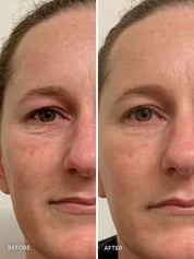 Vitamin C Paste with 10% L-Absorbic Acid